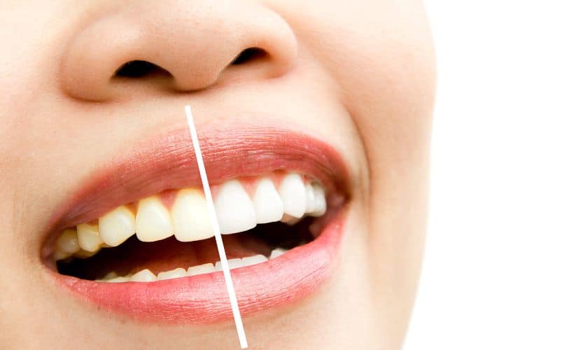 The Ultimate Guide to Tooth Brushing: Achieve a Brighter Smile Today!